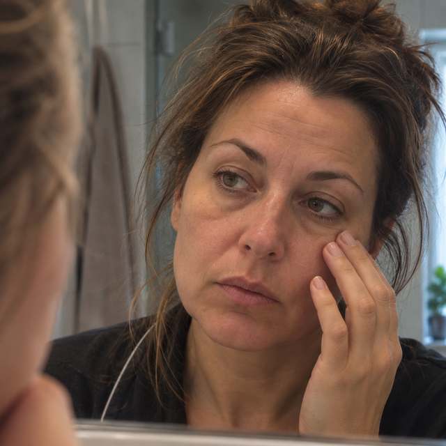 Woman checking her puffy face in the mirror